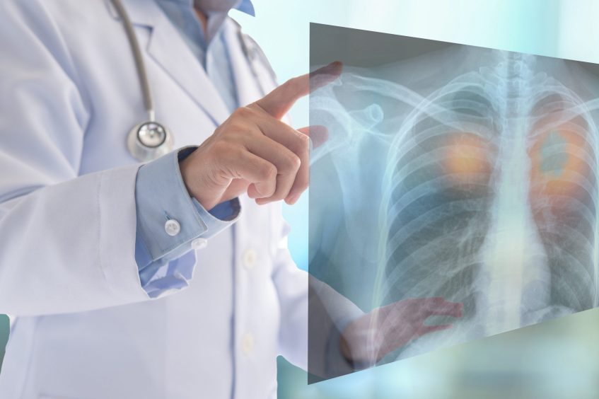 Röntgenbild Arztrecht